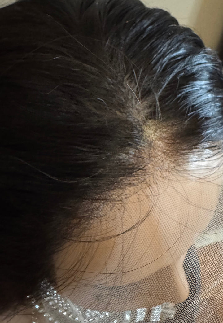 Silk Top Medical Cap Wigs- Dark Brown